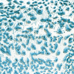 AMACO Speckled Teal Crawl ceramic glaze